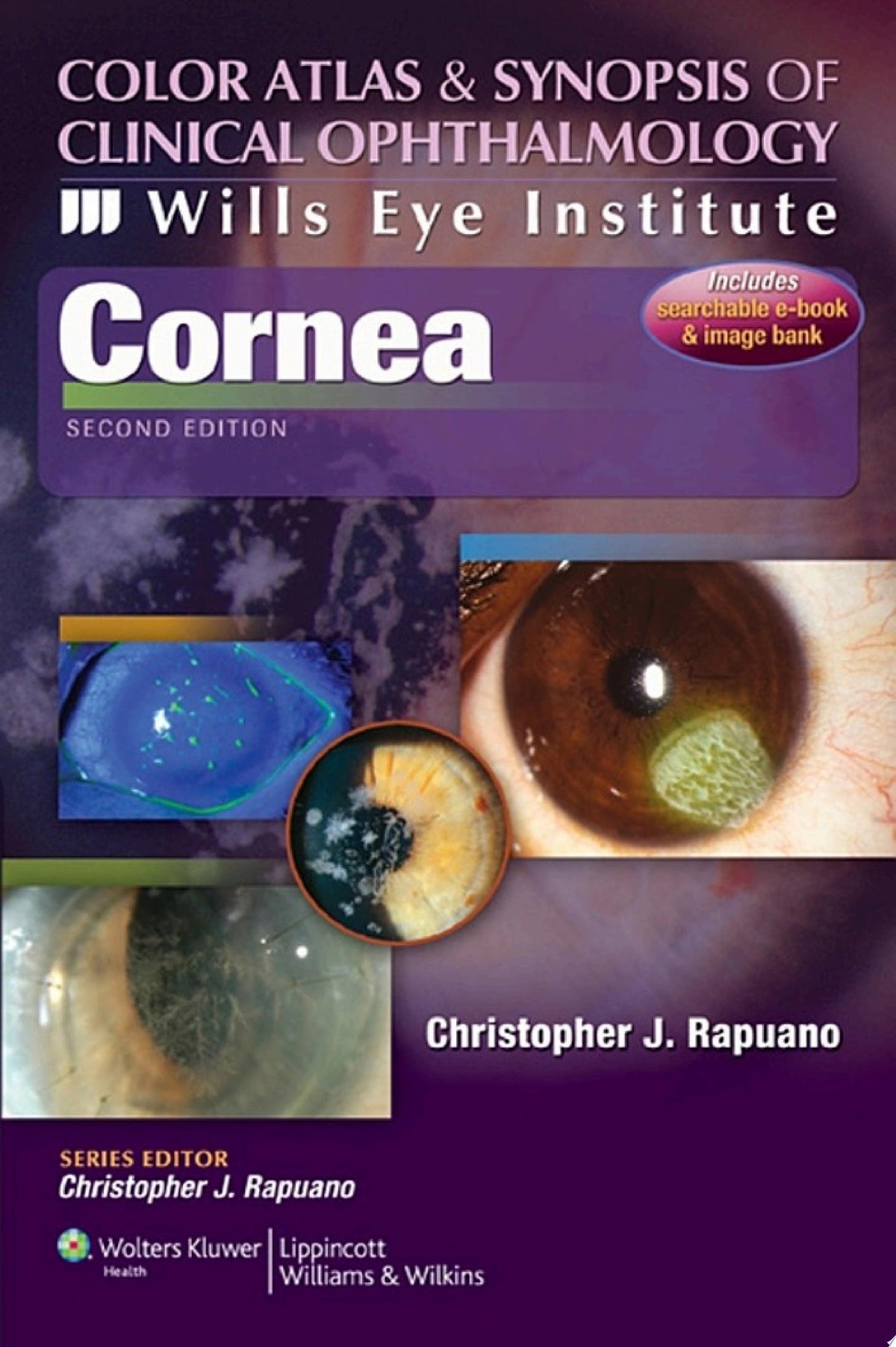 Cornea: Color Atlas & Synopsis of Clinical Ophthalmology 2nd Edition by Rapuano PDF