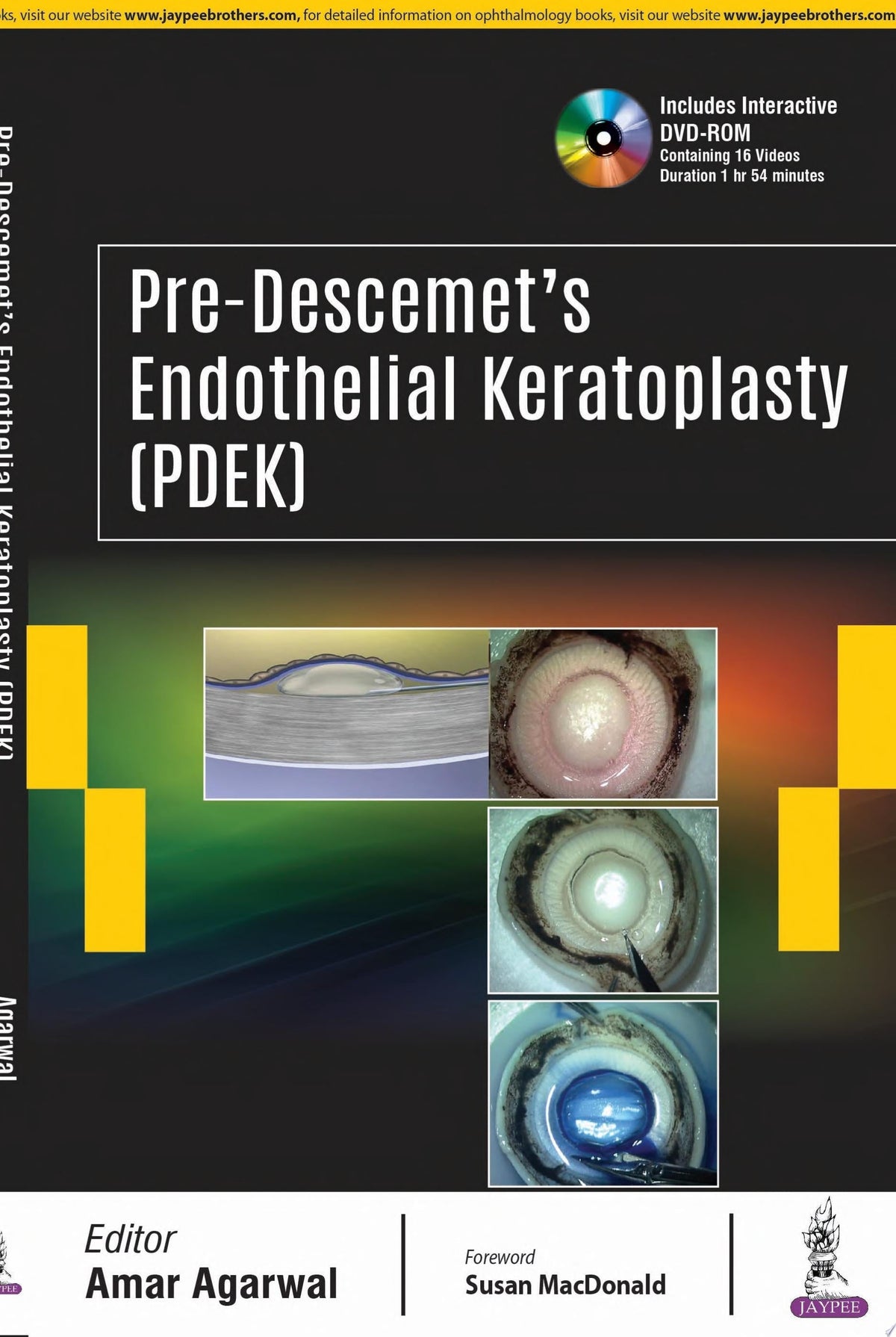 Pre-Descemet’s Endothelial Keratoplasty 1st Edition by Jaypee PDF