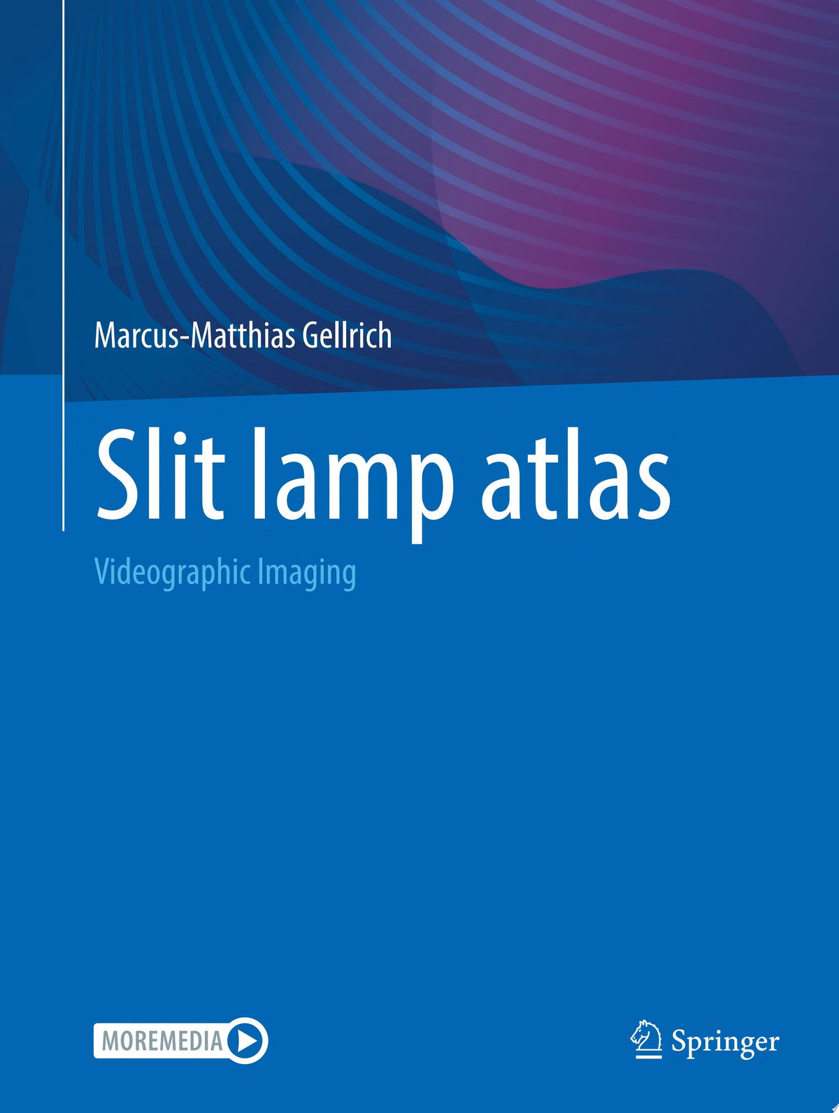 Slit Lamp Atlas: Videographic Imaging 2025th Edition by Gellrich PDF