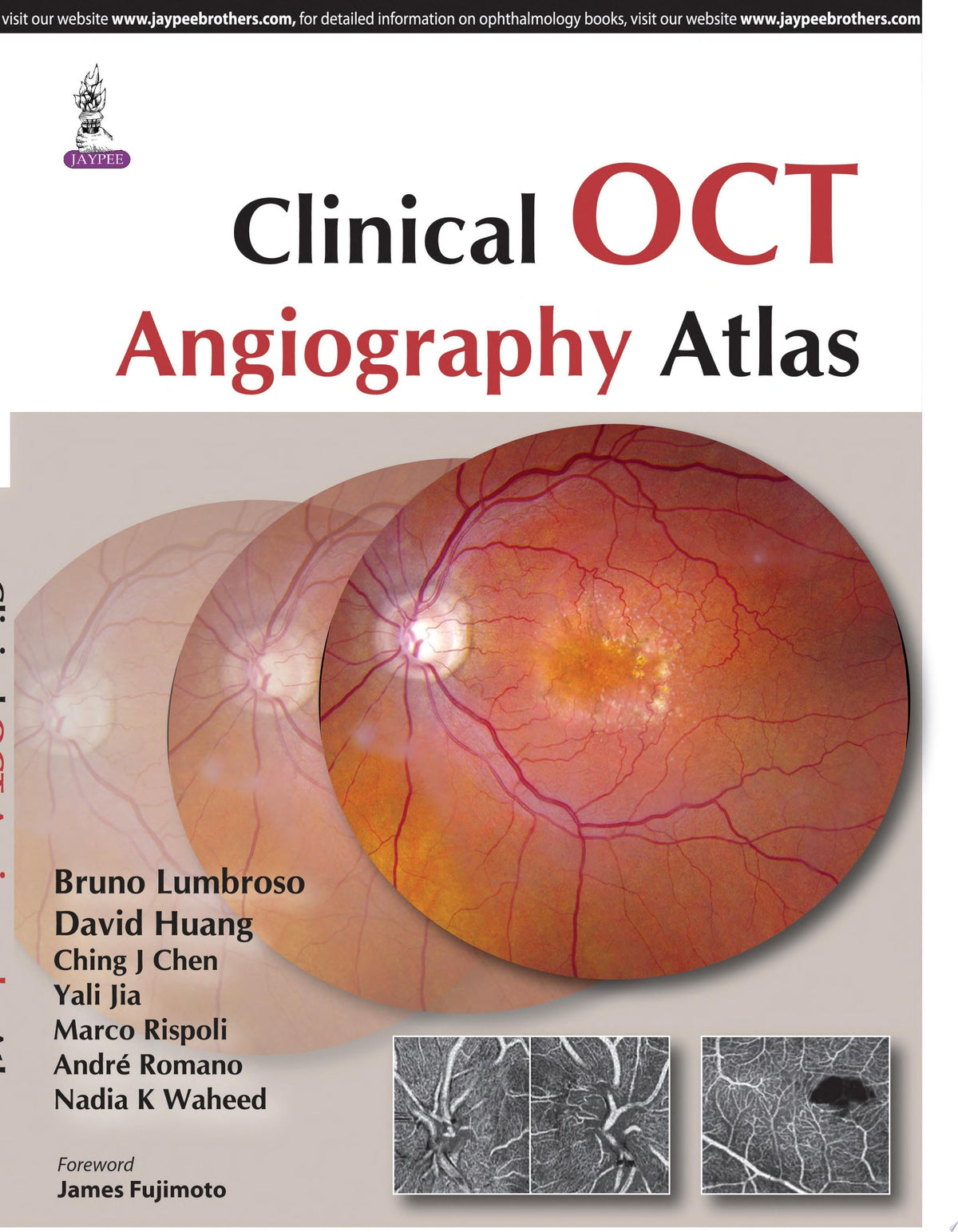 Clinical OCT Angiography Atlas 2nd Edition by Chen PDF