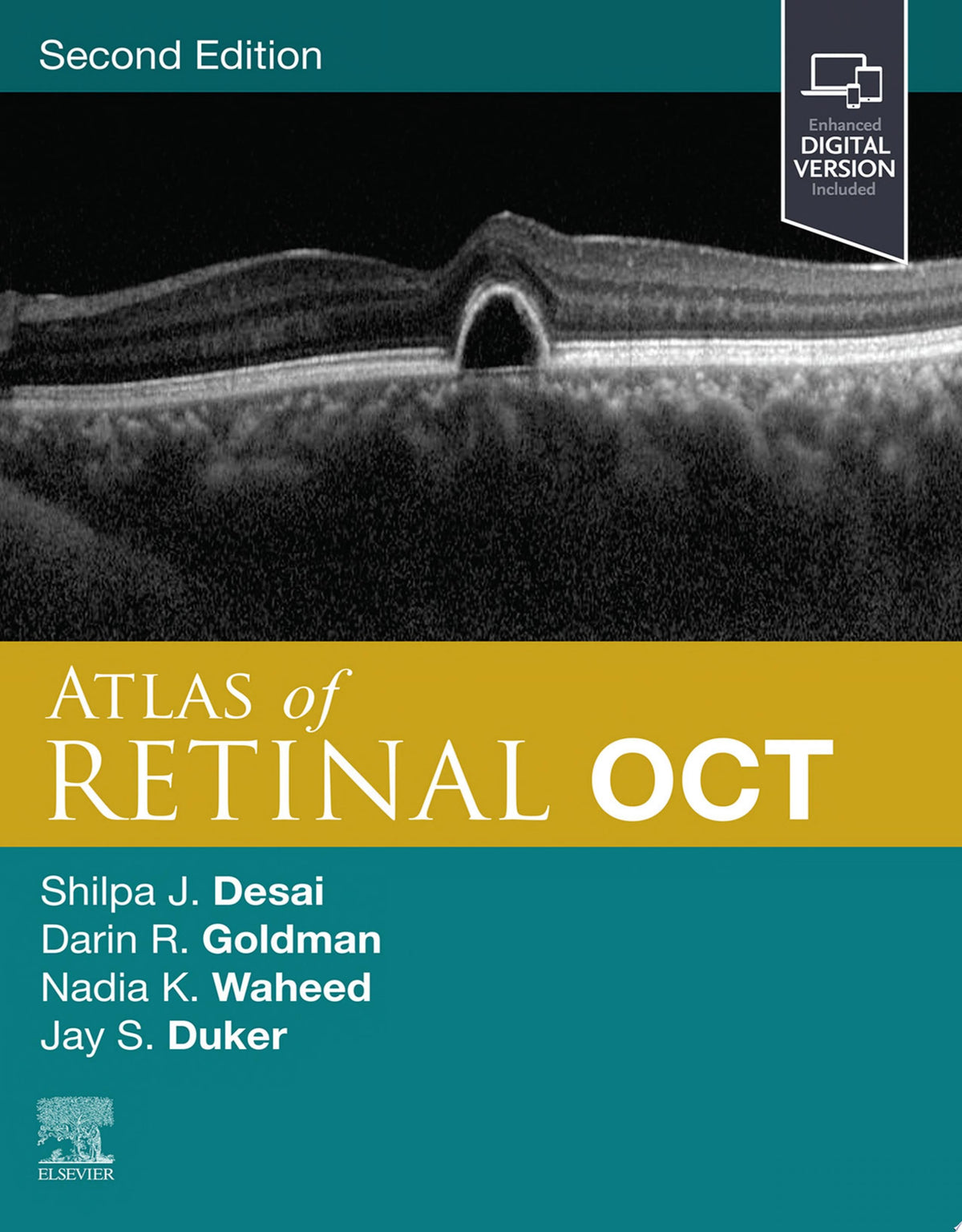 Atlas of Retinal OCT 2nd Edition by Elsevier PDF