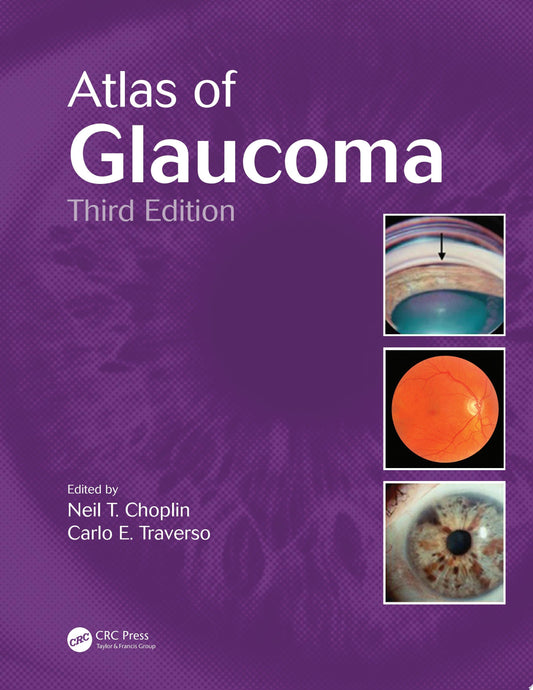 Atlas of Glaucoma 3rd Edition by Choplin PDF