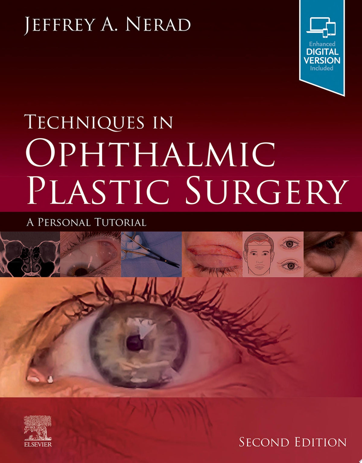 Techniques in Ophthalmic Plastic Surgery 2nd Edition by Elsevier PDF