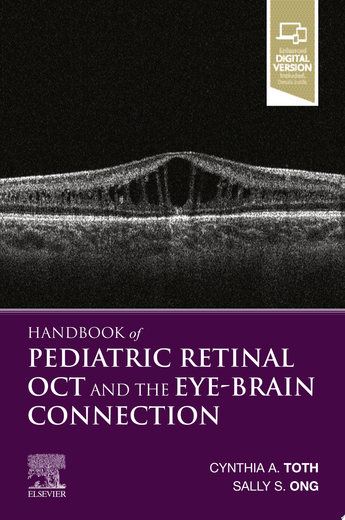 Handbook of Pediatric Retinal OCT 1st Edition by Elsevier PDF