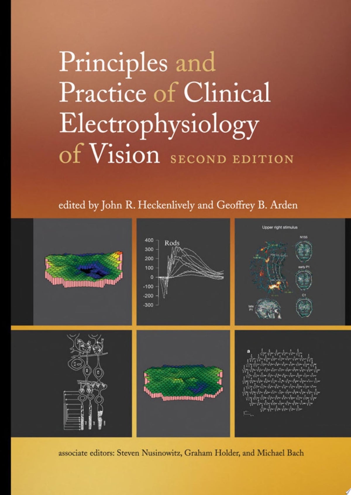 Fundus Autofluorescence 2nd Edition PDF